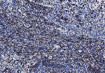 CD7 Rabbit Monoclonal Antibody | 兔单抗 | EnkiLife恩玑生命