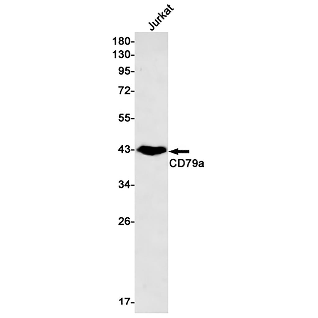 CD79a Rabbit Monoclonal Antibody | 兔单抗 | EnkiLife恩玑生命