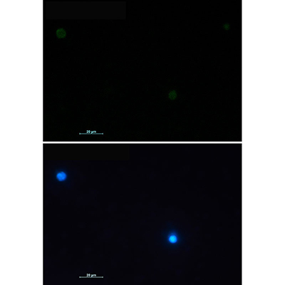 CD79a Rabbit Monoclonal Antibody | 兔单抗 | EnkiLife恩玑生命