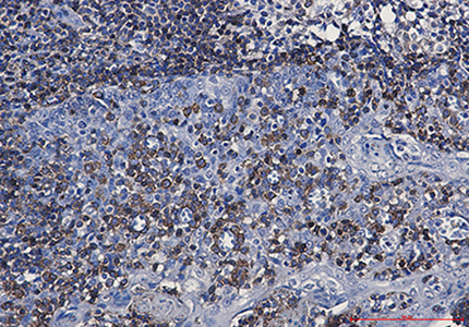 CD79a Rabbit Monoclonal Antibody | 兔单抗 | EnkiLife恩玑生命