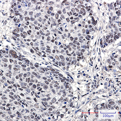 Cullin 4A/4B Rabbit Monoclonal Antibody | 兔单抗 | EnkiLife恩玑生命