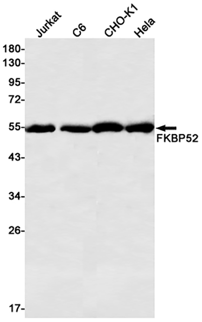 FKBP52 Rabbit Monoclonal Antibody | 兔单抗 | EnkiLife恩玑生命