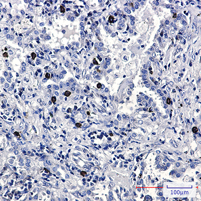 FLI1 Rabbit Monoclonal Antibody | 兔单抗 | EnkiLife恩玑生命