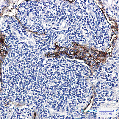 Folate Binding Protein Rabbit Monoclonal Antibody | 兔单抗 | EnkiLife恩玑生命