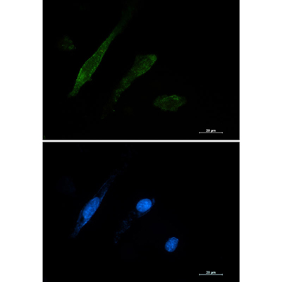 Galectin 3 Rabbit Monoclonal Antibody | 兔单抗 | EnkiLife恩玑生命