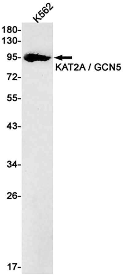 KAT2A Rabbit Monoclonal Antibody | 兔单抗 | EnkiLife恩玑生命