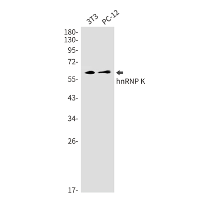 hnRNP K Rabbit Monoclonal Antibody | 兔单抗 | EnkiLife恩玑生命