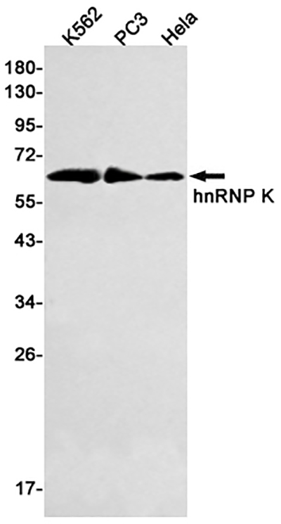 hnRNP K Rabbit Monoclonal Antibody | 兔单抗 | EnkiLife恩玑生命