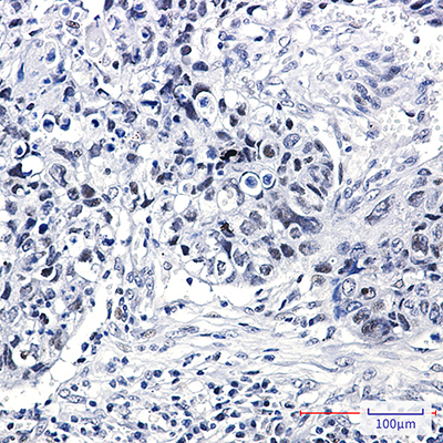hnRNP K Rabbit Monoclonal Antibody | 兔单抗 | EnkiLife恩玑生命