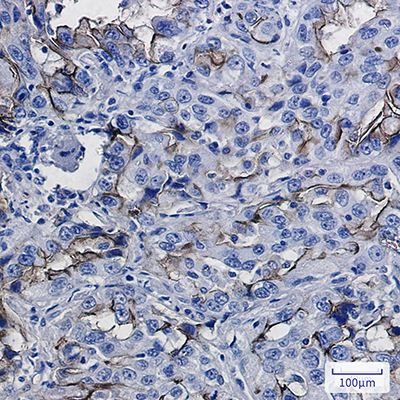 ICAM1 Rabbit Monoclonal Antibody | 兔单抗 | EnkiLife恩玑生命