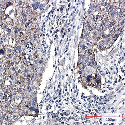 Junctional Adhesion Molecule 1 Rabbit Monoclonal Antibody | 兔单抗 | EnkiLife恩玑生命