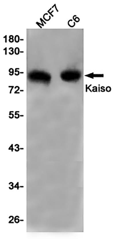 Kaiso Rabbit Monoclonal Antibody | 兔单抗 | EnkiLife恩玑生命