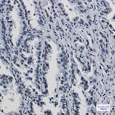 KAP1 Rabbit Monoclonal Antibody | 兔单抗 | EnkiLife恩玑生命