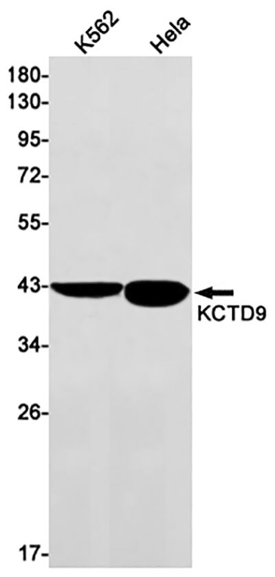 KCTD9 Rabbit Monoclonal Antibody | 兔单抗 | EnkiLife恩玑生命