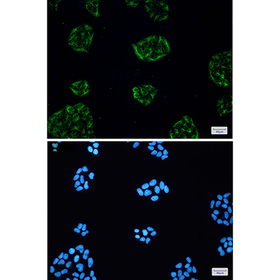 KCTD9 Rabbit Monoclonal Antibody | 兔单抗 | EnkiLife恩玑生命