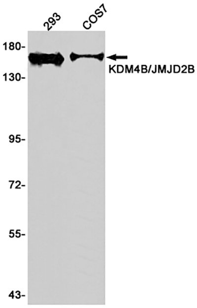 KDM4B Rabbit Monoclonal Antibody | 兔单抗 | EnkiLife恩玑生命