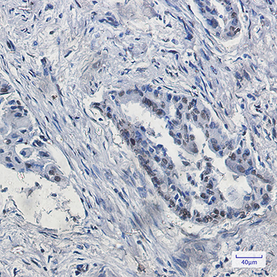 KDM4B Rabbit Monoclonal Antibody | 兔单抗 | EnkiLife恩玑生命