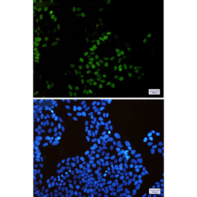 KIFC1 Rabbit Monoclonal Antibody | 兔单抗 | EnkiLife恩玑生命
