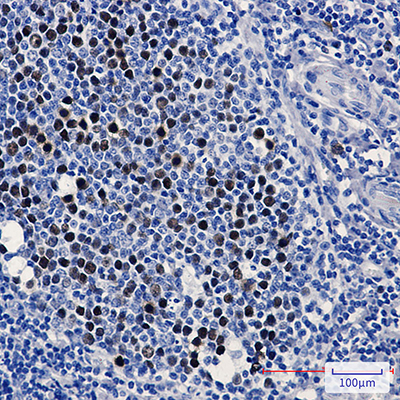 KIFC1 Rabbit Monoclonal Antibody | 兔单抗 | EnkiLife恩玑生命