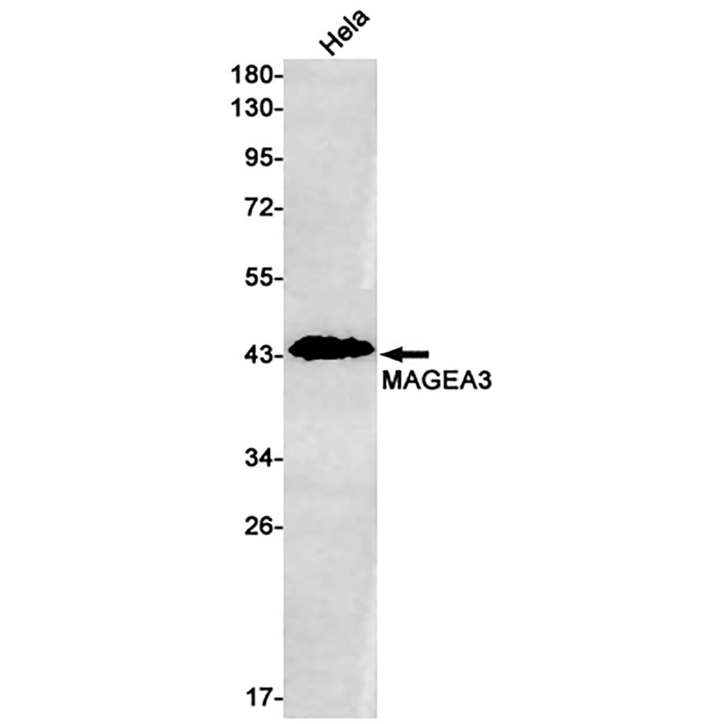 MAGEA3 Rabbit Monoclonal Antibody | 兔单抗 | EnkiLife恩玑生命
