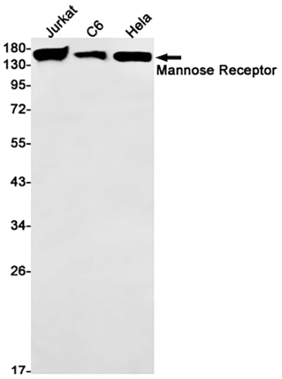 Mannose Receptor Rabbit Monoclonal Antibody | 兔单抗 | EnkiLife恩玑生命