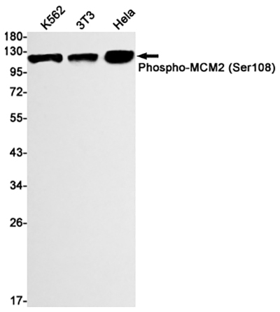 Phospho-MCM2 (Ser108) Rabbit Monoclonal Antibody | 兔单抗 | EnkiLife恩玑生命