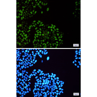 Phospho-MCM2 (Ser108) Rabbit Monoclonal Antibody | 兔单抗 | EnkiLife恩玑生命