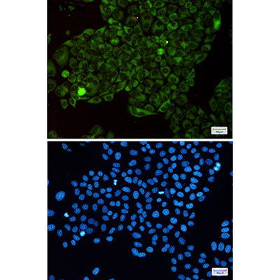 MetRS Rabbit Monoclonal Antibody | 兔单抗 | EnkiLife恩玑生命