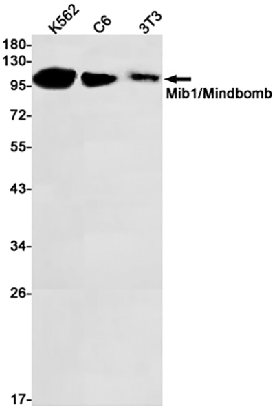 MIB1 Rabbit Monoclonal Antibody | 兔单抗 | EnkiLife恩玑生命