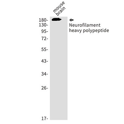 Neurofilament Heavy Polypeptide Rabbit Monoclonal Antibody | 兔单抗 | EnkiLife恩玑生命
