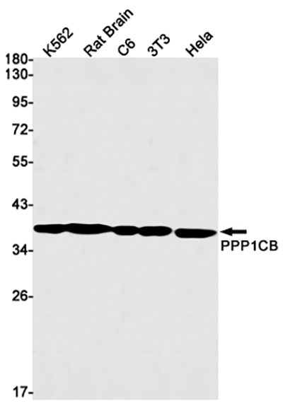 PP1C beta Rabbit Monoclonal Antibody | 兔单抗 | EnkiLife恩玑生命