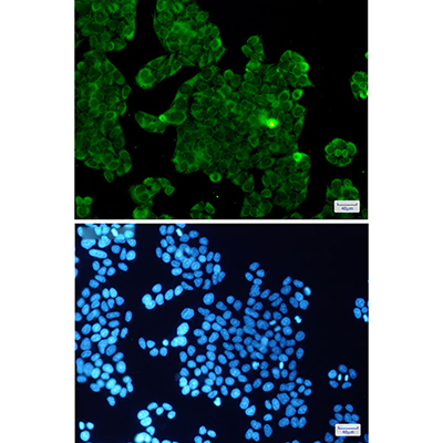 PP1C beta Rabbit Monoclonal Antibody | 兔单抗 | EnkiLife恩玑生命