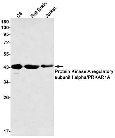 PKA RI alpha Rabbit Monoclonal Antibody | 兔单抗 | EnkiLife恩玑生命