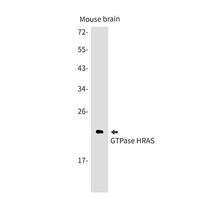 GTPase HRAS Rabbit Monoclonal Antibody | 兔单抗 | EnkiLife恩玑生命