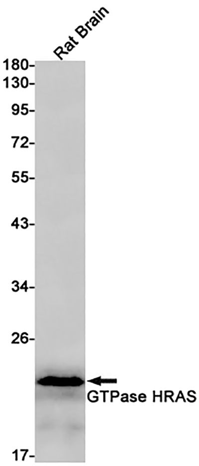 GTPase HRAS Rabbit Monoclonal Antibody | 兔单抗 | EnkiLife恩玑生命