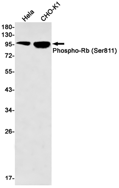 Phospho-Rb (Ser811) Rabbit Monoclonal Antibody | 兔单抗 | EnkiLife恩玑生命