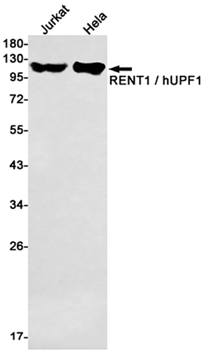 RENT1 Rabbit Monoclonal Antibody | 兔单抗 | EnkiLife恩玑生命