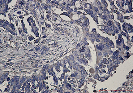 RENT1 Rabbit Monoclonal Antibody | 兔单抗 | EnkiLife恩玑生命