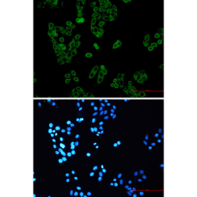 RENT1 Rabbit Monoclonal Antibody | 兔单抗 | EnkiLife恩玑生命