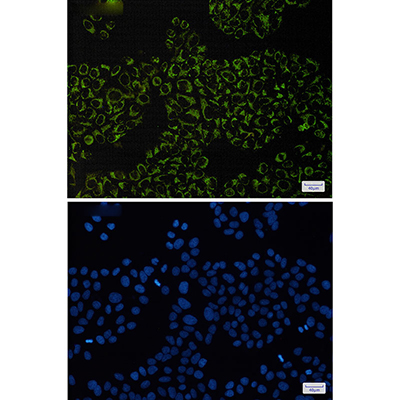 Complex III Subunit 5 Rabbit Monoclonal Antibody | 兔单抗 | EnkiLife恩玑生命