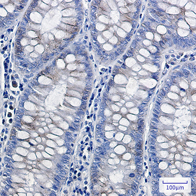 Complex III Subunit 5 Rabbit Monoclonal Antibody | 兔单抗 | EnkiLife恩玑生命