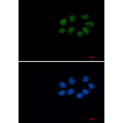 Phospho-Vimentin (Ser56) Rabbit Monoclonal Antibody | 兔单抗 | EnkiLife恩玑生命