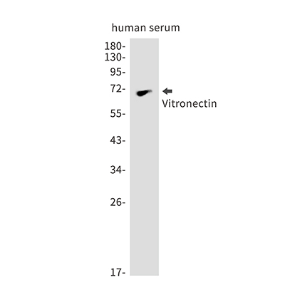 Vitronectin Rabbit Monoclonal Antibody | 兔单抗 | EnkiLife恩玑生命