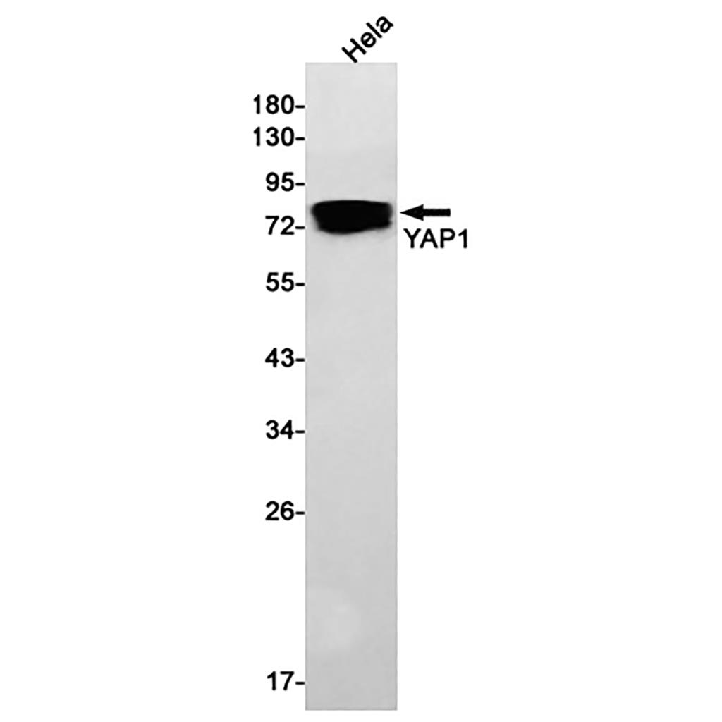 YAP1 Rabbit Monoclonal Antibody | 兔单抗 | EnkiLife恩玑生命