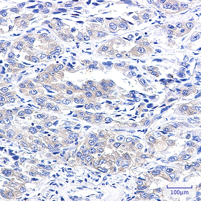 A RAF Rabbit Monoclonal Antibody | 兔单抗 | EnkiLife恩玑生命