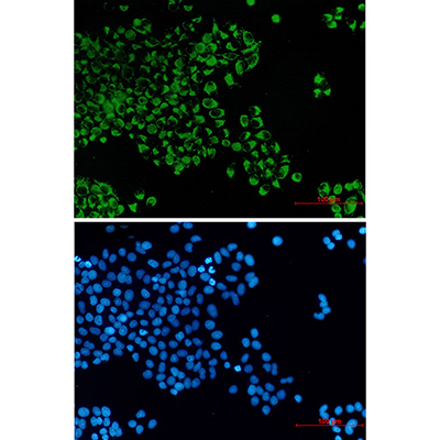 Bcl2 L14 Rabbit Monoclonal Antibody | 兔单抗 | EnkiLife恩玑生命