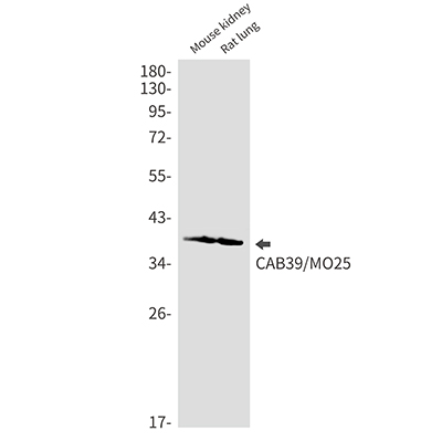 CAB39 Rabbit Monoclonal Antibody | 兔单抗 | EnkiLife恩玑生命