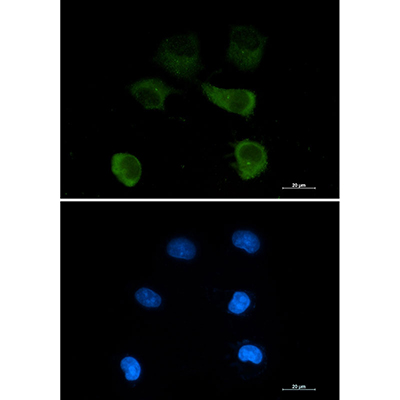 gamma Tubulin Rabbit Monoclonal Antibody | 兔单抗 | EnkiLife恩玑生命