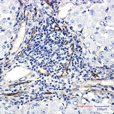 ORAI3 Rabbit Monoclonal Antibody | 兔单抗 | EnkiLife恩玑生命