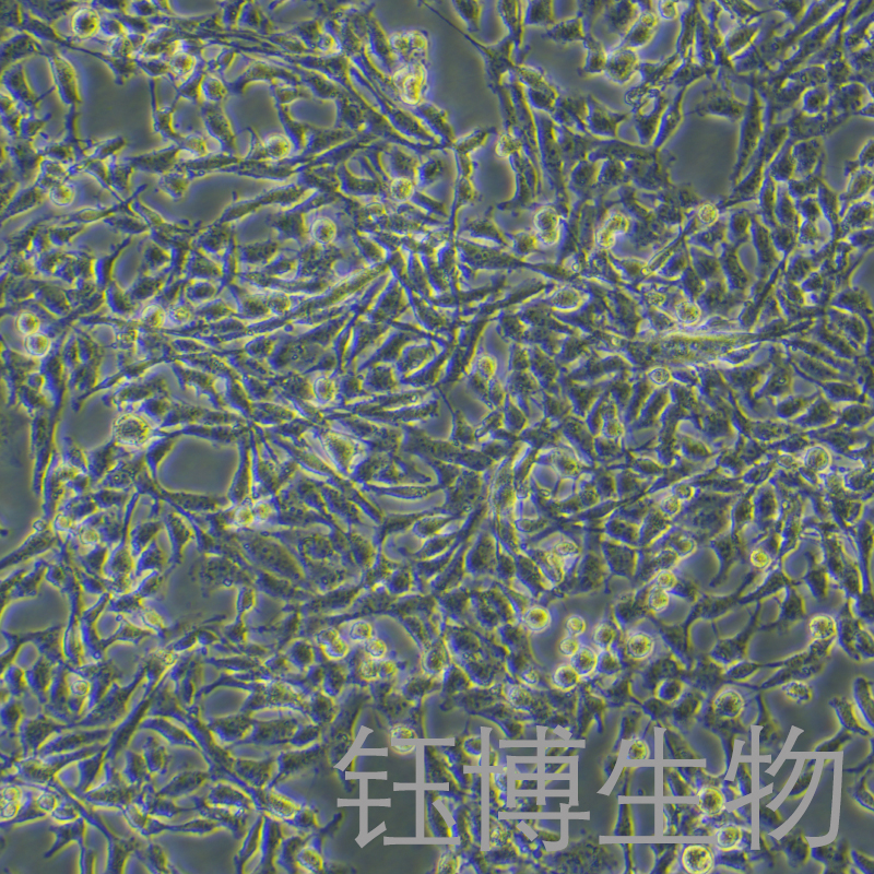 SNU-16（人胃癌细胞）YB-71805HC